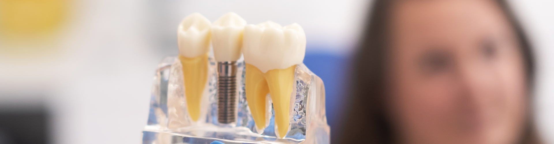 gloved hand holding model of an implant between teeth in front of patient